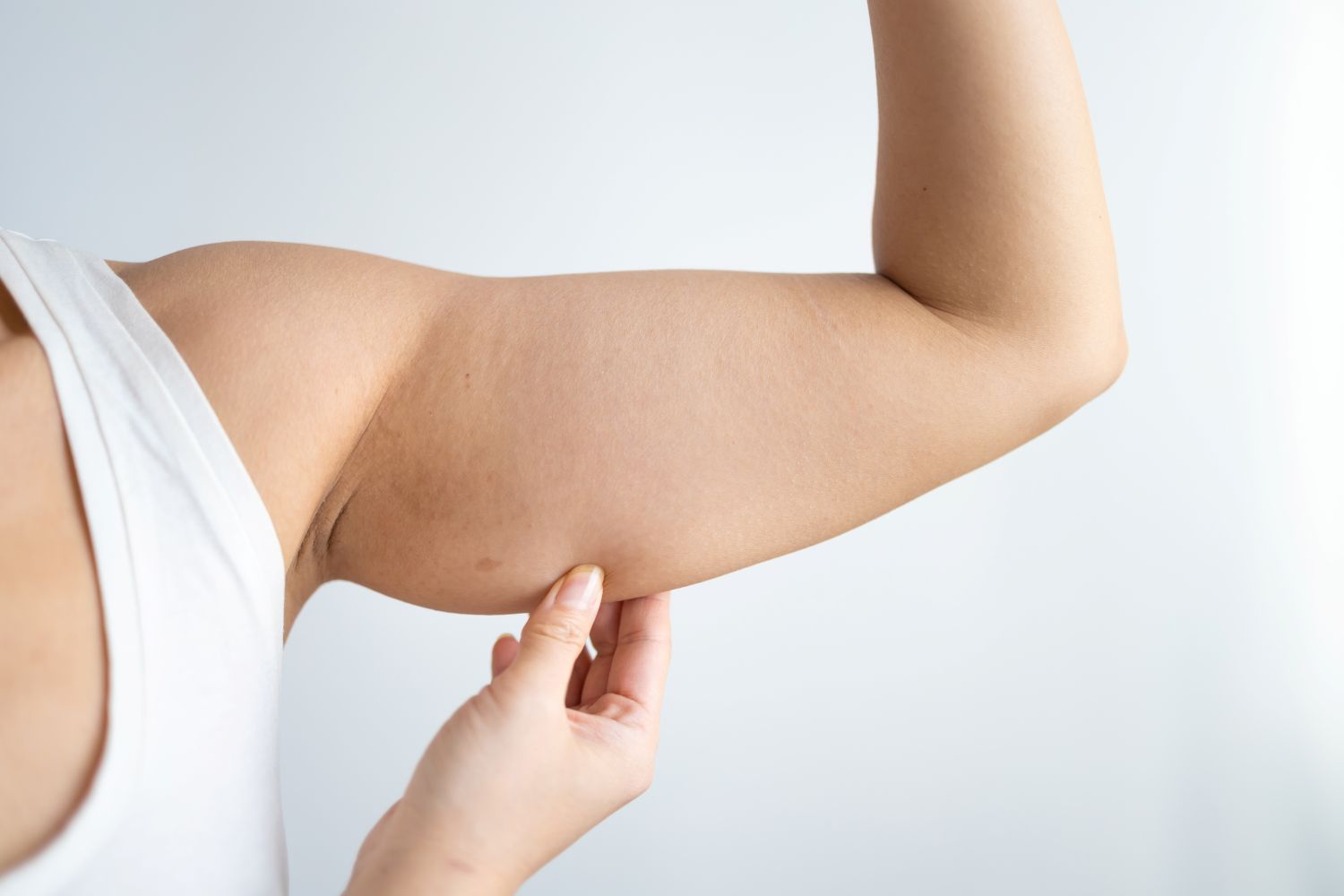 woman showing excess fat on arm